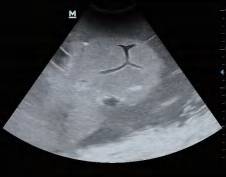 DS-40303 - Ultrasound-Guided Liver Puncture Model Ultrasound-Guided Liver Puncture Model