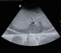 DS-40303 - Ultrasound-Guided Liver Puncture Model Ultrasound-Guided Liver Puncture Model