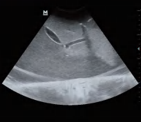 DS-40303 - Ultrasound-Guided Liver Puncture Model Ultrasound-Guided Liver Puncture Model