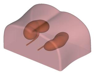 DS-40304 - Ultrasound-Guided Percutaneous Renal Puncture Model Ultrasound-Guided Percutaneous Renal Puncture Model