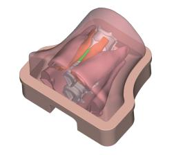 DS-40305 - Ultrasound-Guided Thyroid Puncture Model (Advanced) Ultrasound-Guided Thyroid Puncture Model (Advanced)