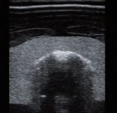 DS-40305 - Ultrasound-Guided Thyroid Puncture Model (Advanced) Ultrasound-Guided Thyroid Puncture Model (Advanced)