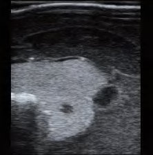 DS-40305 - Ultrasound-Guided Thyroid Puncture Model (Advanced) Ultrasound-Guided Thyroid Puncture Model (Advanced)