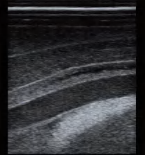 DS-40305 - Ultrasound-Guided Thyroid Puncture Model (Advanced) Ultrasound-Guided Thyroid Puncture Model (Advanced)