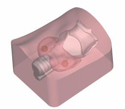 DS-40306 - Ultrasound-Guided Thyroid Puncture Model Ultrasound-Guided Thyroid Puncture Model
