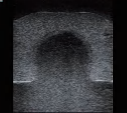 DS-40306 - Ultrasound-Guided Thyroid Puncture Model Ultrasound-Guided Thyroid Puncture Model