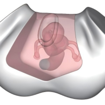 Transrectal Uterine Ultrasound Model