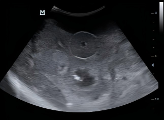 DS-40308 - Transrectal Prostate Ultrasound Model Transrectal Prostate Ultrasound Model