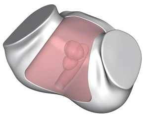 DS-40308 - Transrectal Prostate Ultrasound Model Transrectal Prostate Ultrasound Model