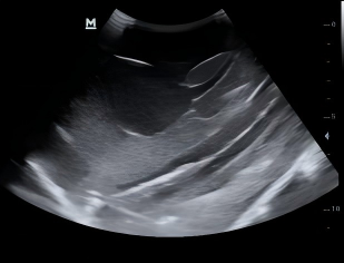 DS-40308 - Transrectal Prostate Ultrasound Model Transrectal Prostate Ultrasound Model