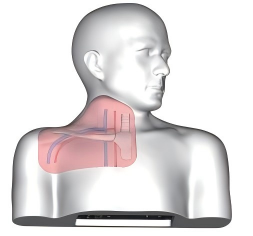 DS-40309 - Ultrasound-Guided Central Venous Access Model Ultrasound-Guided Central Venous Access Model