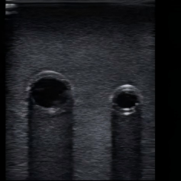 Ultrasound-Guided Central Venous Access Model