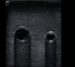DS-40309 - Ultrasound-Guided Central Venous Access Model Ultrasound-Guided Central Venous Access Model