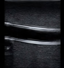 DS-40309 - Ultrasound-Guided Central Venous Access Model Ultrasound-Guided Central Venous Access Model