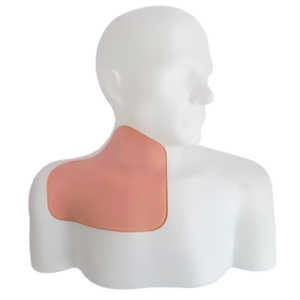 Ultrasound-Guided Central Venous Access Model