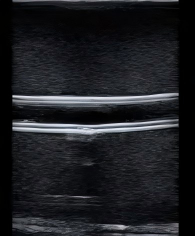 DS-40309 - Ultrasound-Guided Central Venous Access Model Ultrasound-Guided Central Venous Access Model