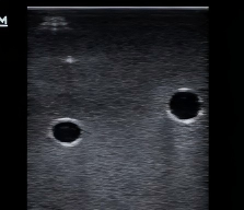 DS-40401 - Ultrasound-Guided Vascular Access Model (with Pump) Ultrasound-Guided Vascular Access Model (with Pump)