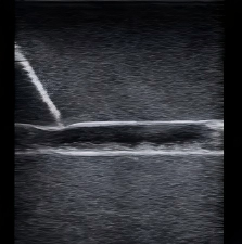 DS-40401 - Ultrasound-Guided Vascular Access Model (with Pump) Ultrasound-Guided Vascular Access Model (with Pump)