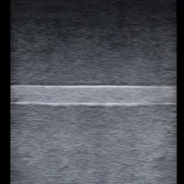 Ultrasound-Guided Multi-Target Puncture Model