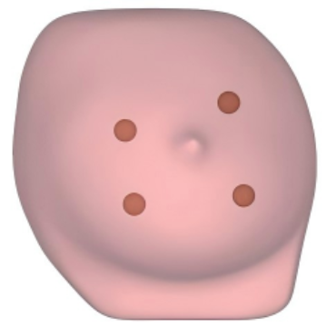 Ultrasound-Guided Breast Biopsy Model
