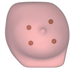DS-40404 - Ultrasound-Guided Breast Biopsy Model Ultrasound-Guided Breast Biopsy Model