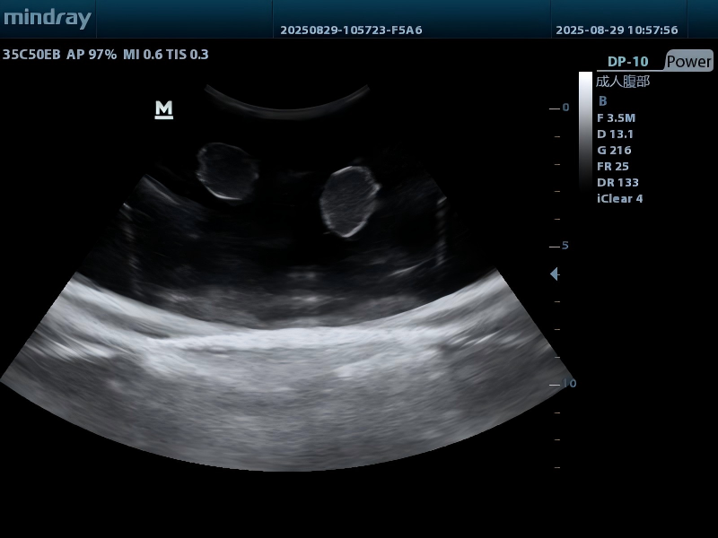 DS-40406 - Visualizable Ablation Training Phantom Visualizable Ablation Training Phantom