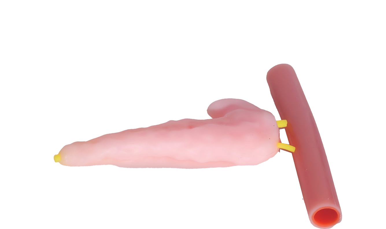 DS-40421 - Pancreaticojejunostomy Training Model Pancreaticojejunostomy Training Model