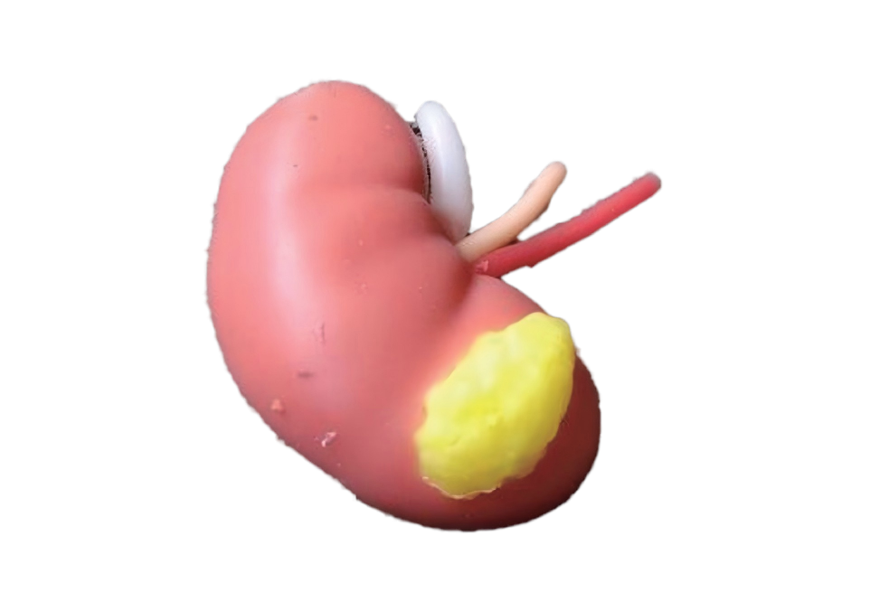 DS-40422 - Kidney Lesion Model Kidney Lesion Model