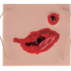 Wound pad I
