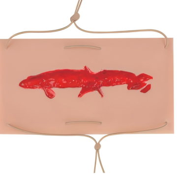 Wound pad II