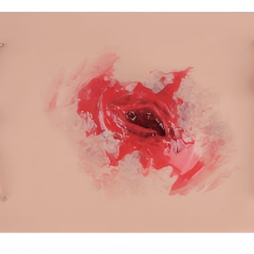 Wound skin pad