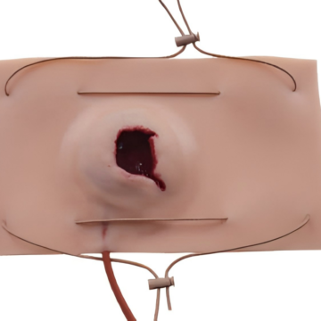 Gunshot Wound module