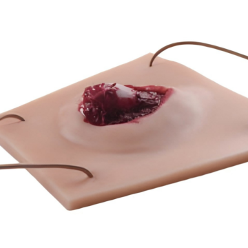 Limb Open Fracture Module