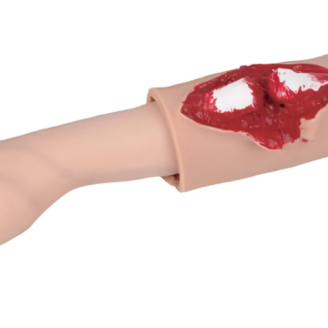 Open Fracture of Tibia Training Module