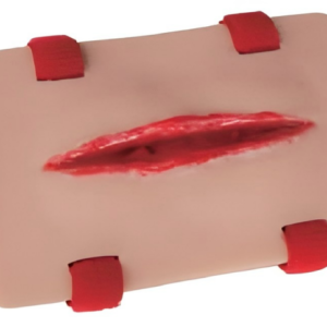 Open Fracture of Tibia Training Module
