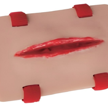 Open Fracture of Tibia Training Module