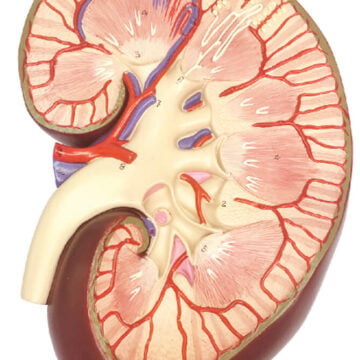 Kidney , 3x Enlarged