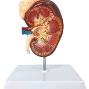 Kidney with Adrenal Gland, 1.5x Enlarged, 2 Parts