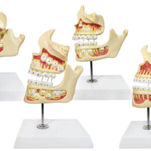 Tooth Development Model, 4 Stages, 4 Parts