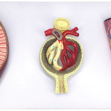Kidney Cross-Section, Nephron, Glomerular Model