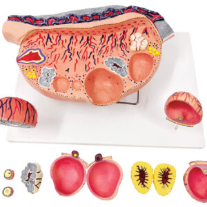 Ovary with Ovarian Follicles & Ovulation (12× Enlarged), 13 Parts