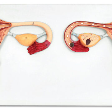 Fertilization Process Model, 2 Parts