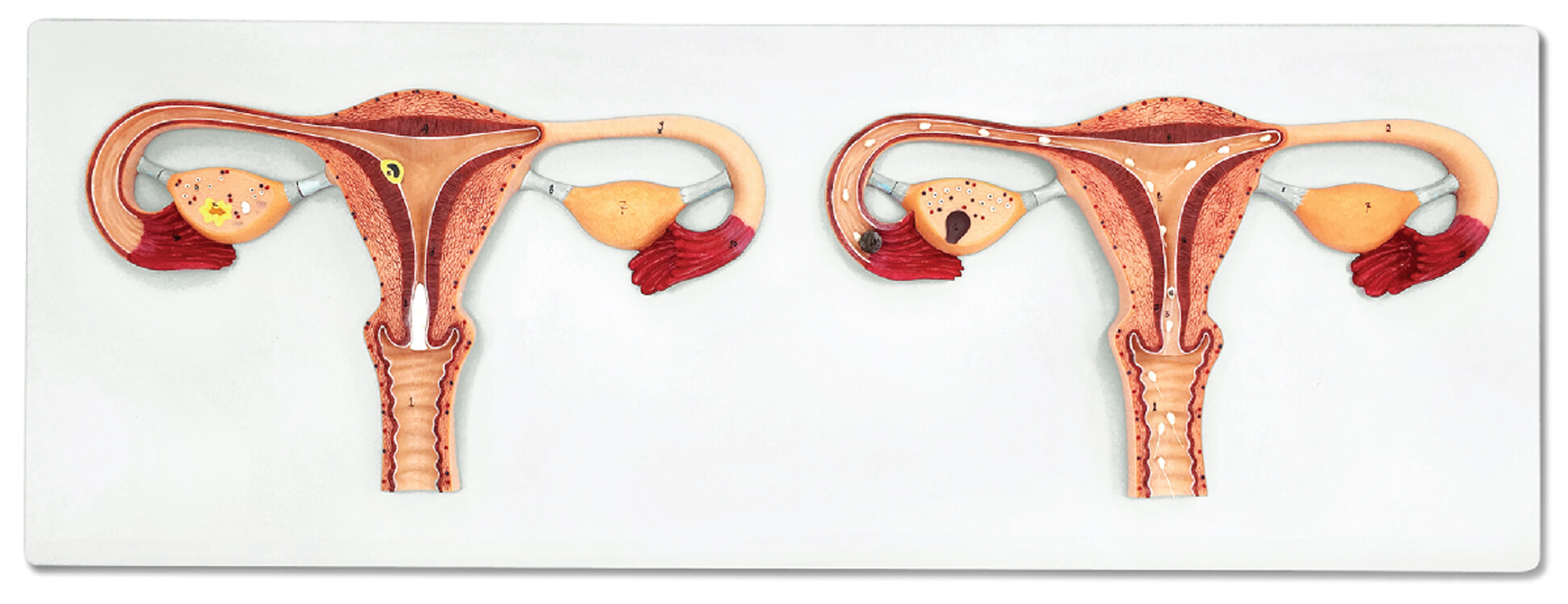 DS-50585 - Fertilization Process Model, 2 Parts Fertilization Process Model, 2 Parts