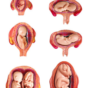 Pregnancy Series, Life Size, 14 Parts