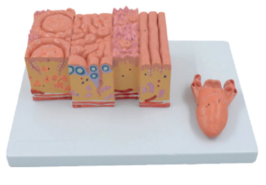 DS-50659 - Tongue Model, 2 Parts Tongue Model, 2 Parts