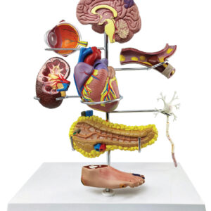 Diabitis Disease Organs Model, 9 Parts