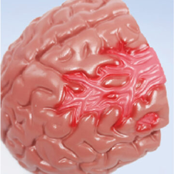 Brain Pathologies, Stroke, Life Size, 1 Part