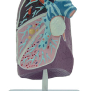 Pathological Model of the Lung, 2/3 Life Size, 1 Part