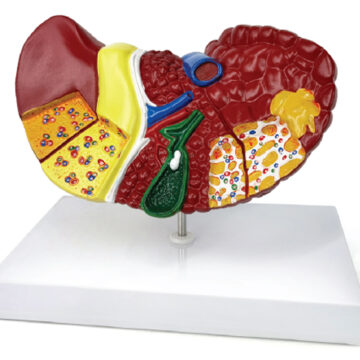Pathological Model of the Liver