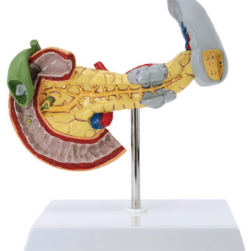 Pathological Model of the Pancreas, Spleen, and Duodenum, Life Size